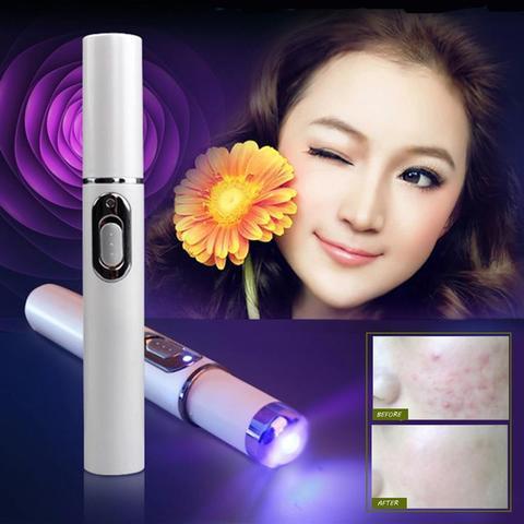 Blue Light Therapy Acne Laser Pen Soft Scar Wrinkle Removal Treatment Device Skin Care Beauty Equipment - Image 2