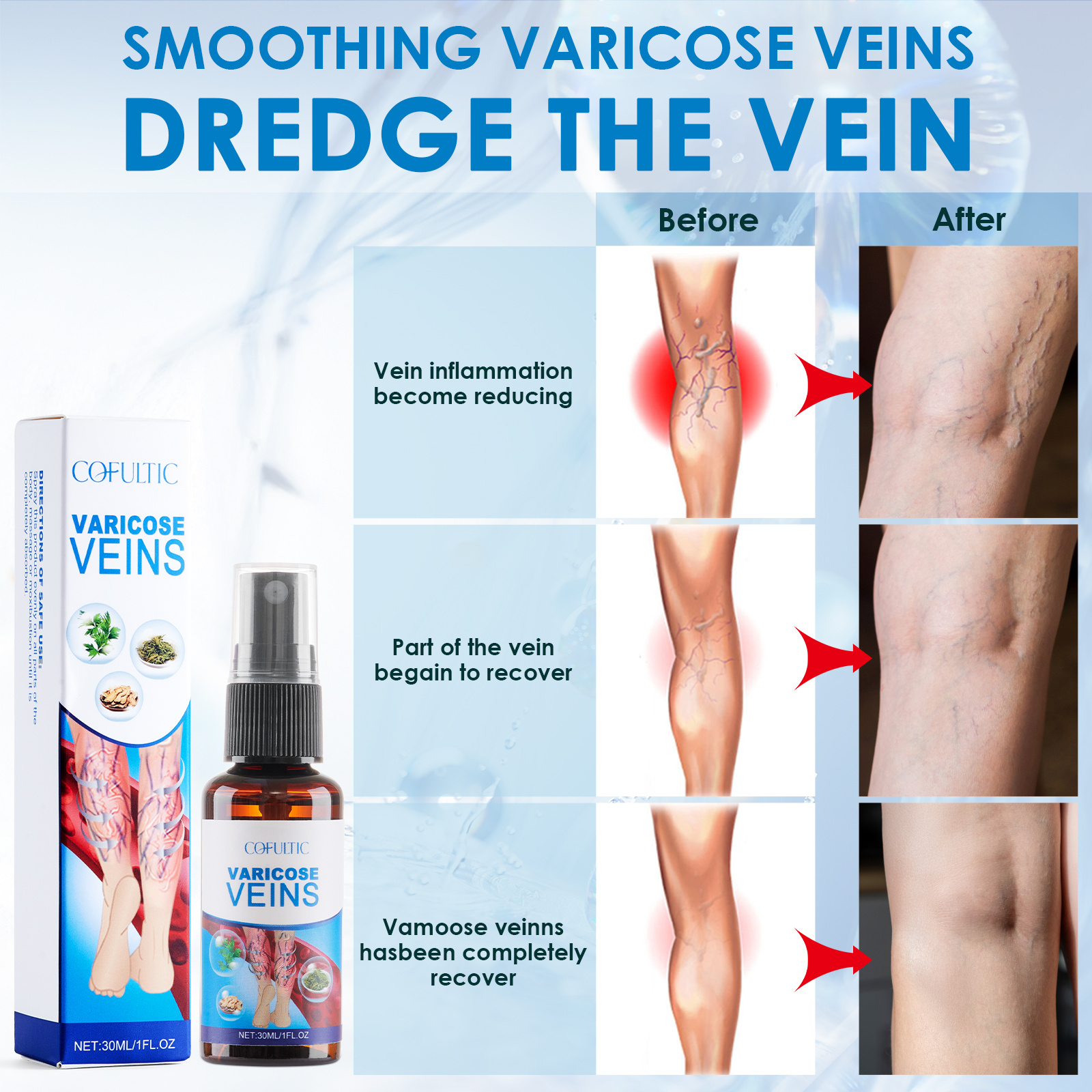 30ml Varicose Vein Spray Multi-Purpose Knee And Leg Care Spray Promote Blood Circulation - Image 5